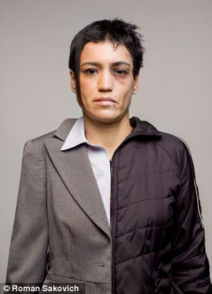 Uyuşturucudan önce uyuşturucudan sonra