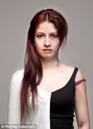 Uyuşturucudan önce uyuşturucudan sonra