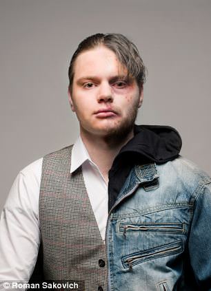 Uyuşturucudan önce uyuşturucudan sonra