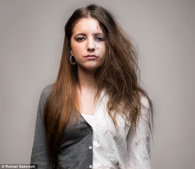 Uyuşturucudan önce uyuşturucudan sonra