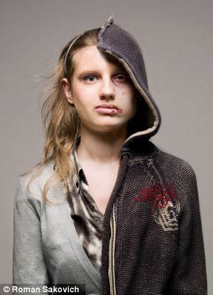 Uyuşturucudan önce uyuşturucudan sonra