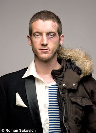 Uyuşturucudan önce uyuşturucudan sonra