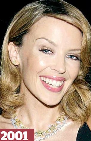 Kylie'nin 25 yıllık değişimi