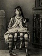 Eşine az rastlanan hastalıklar