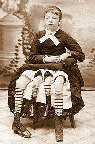 Eşine az rastlanan hastalıklar