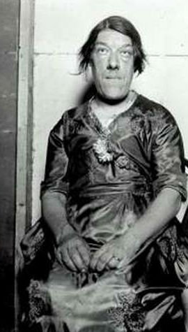 Eşine az rastlanan hastalıklar