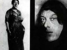 Eşine az rastlanan hastalıklar