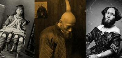 Eşine az rastlanan hastalıklar