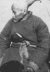 Eşine az rastlanan hastalıklar