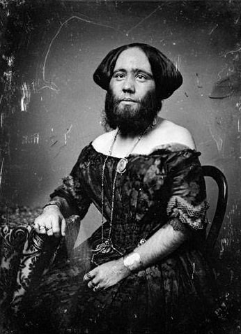 Eşine az rastlanan hastalıklar