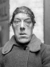 Eşine az rastlanan hastalıklar