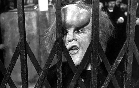 Eşine az rastlanan hastalıklar