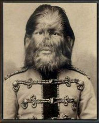 Eşine az rastlanan hastalıklar