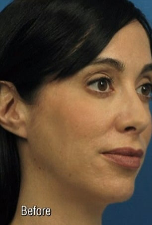 Selfie çektirmek için 9000 euro harcadı