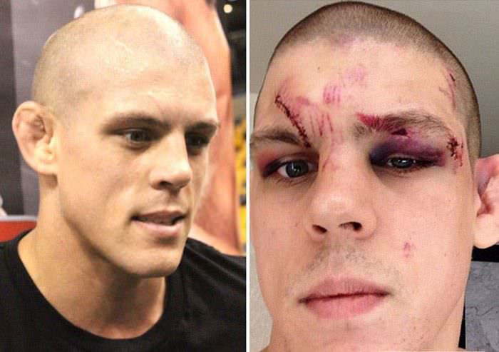 Dövüşten öncesi ve sonrası