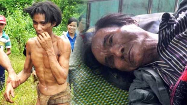 İnanılmaz yaşam hikayeleri