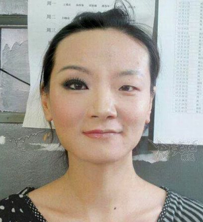 Evde estetik ameliyat yaparcasına değişmelerinin 19 örneği