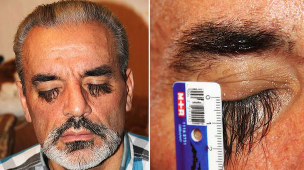 Guinness Rekorlar Kitabı'na girmiş ilginç insanlar