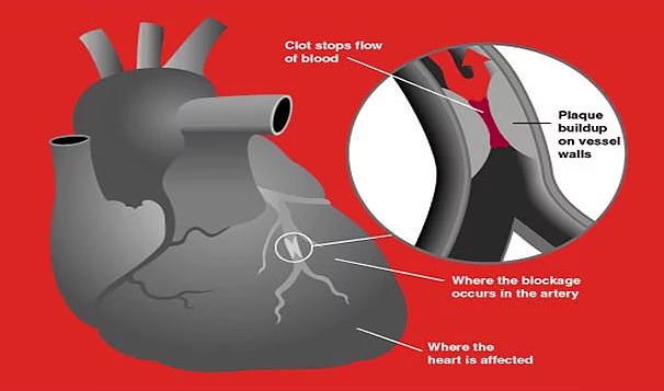 İnanılmaz tesadüfler