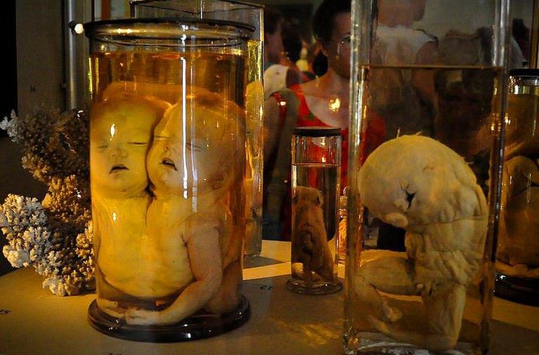 Şaşırtan Müzeler