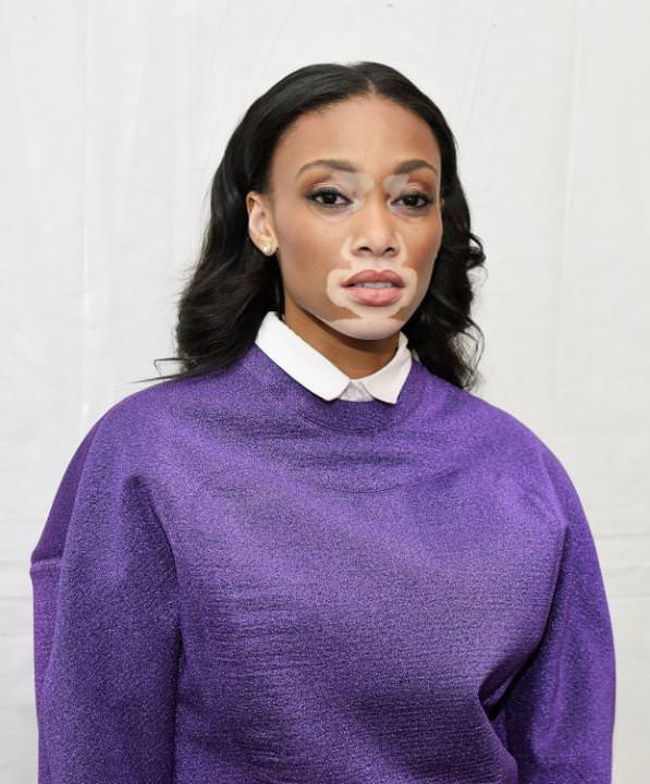 Hastalığını güzelliğe çevirdi