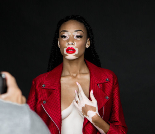 Hastalığını güzelliğe çevirdi