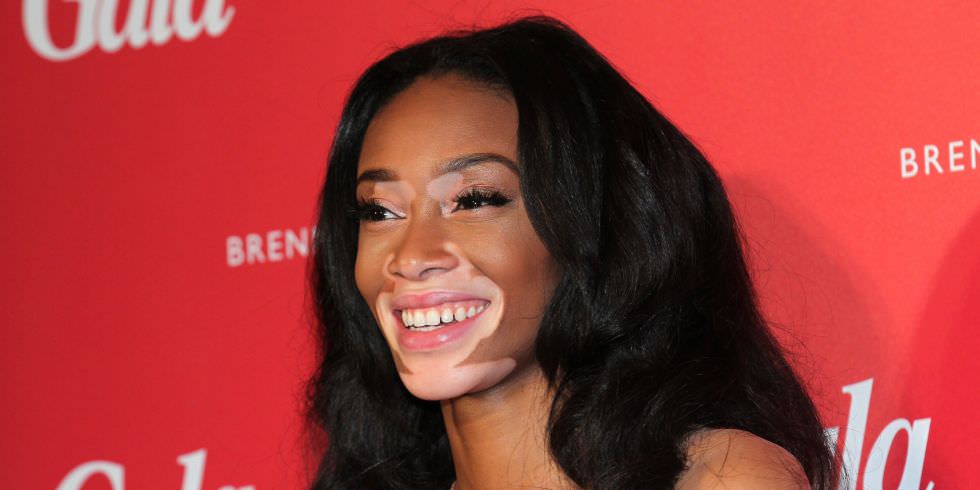 Hastalığını güzelliğe çevirdi