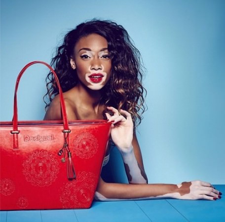 Hastalığını güzelliğe çevirdi