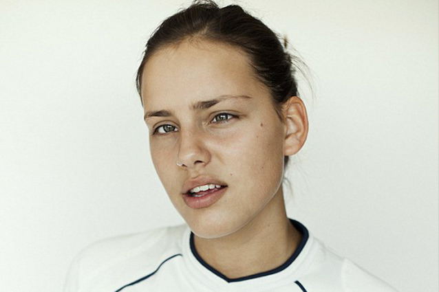 Engeli ve hastalığı ile mutlu  mesut yaşayan 10 model