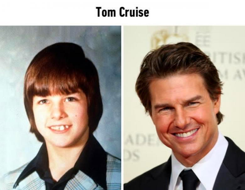 10 ünlünün öğrenci yıllarındaki haliyle şimdiki hali