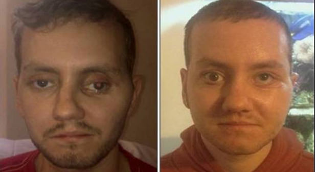 3D yazıcılar hayat değiştiriyor!