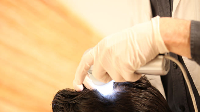 Protez saçta Türkiye’nin bir numarası