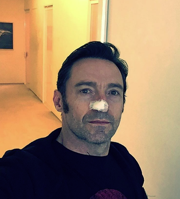 Hugh Jackman tedavi görüyor