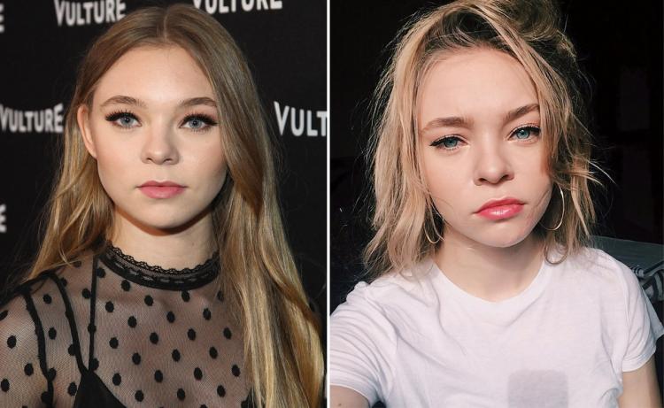 Filmden sonra yüzünde yara izi kaldı, davacı oldu