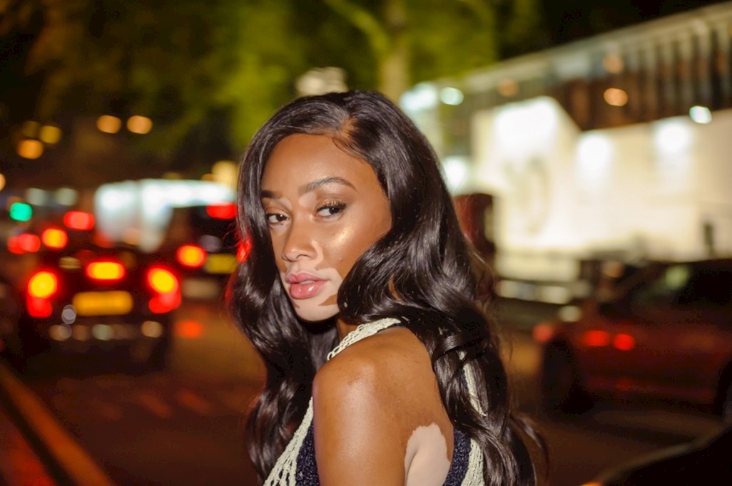 Yeni melek: Winnie Harlow