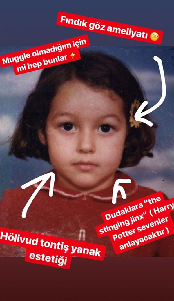 Dilan Çiçek Deniz: Yüzümde hiç estetik yok