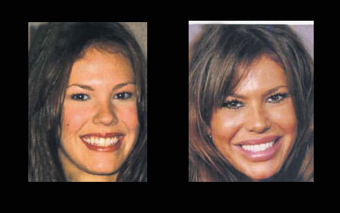 Estetik herkeze yaramıyor!