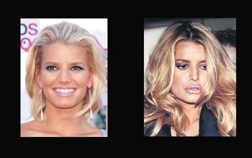 Estetik herkeze yaramıyor!