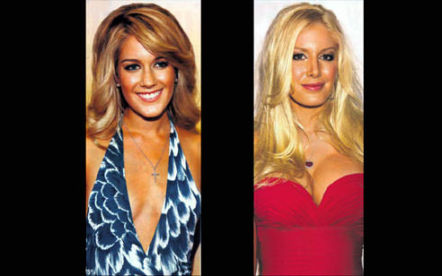 Estetik herkeze yaramıyor!