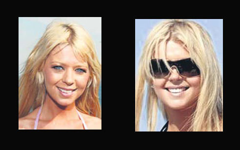 Estetik herkeze yaramıyor!