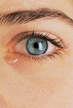 Bahar ayları bu göz hastalığını alevlendiriyor!