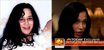 En ilginç estetik operasyonlar