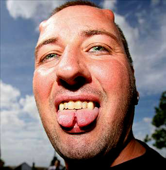 En ilginç estetik operasyonlar