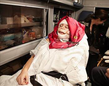 En ilginç estetik operasyonlar