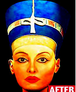 En ilginç estetik operasyonlar