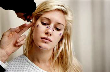 En ilginç estetik operasyonlar