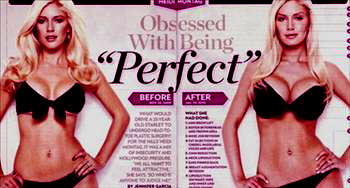 En ilginç estetik operasyonlar