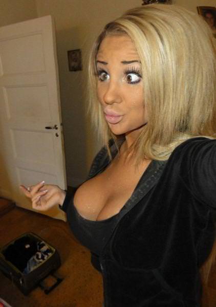 21 yaşında estetik faciası