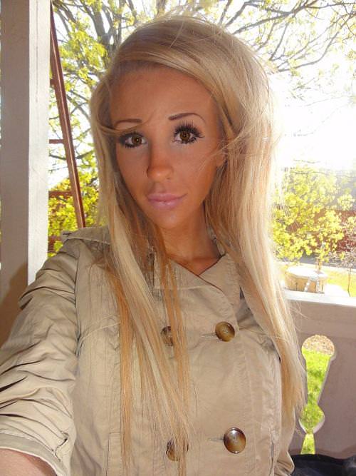 21 yaşında estetik faciası