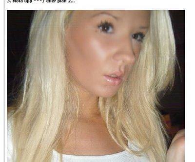 21 yaşında estetik faciası